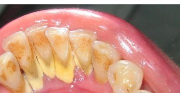 533483391 122186367368442225 4447405085649450298 n