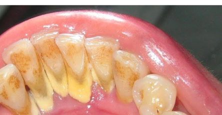 533483391 122186367368442225 4447405085649450298 n