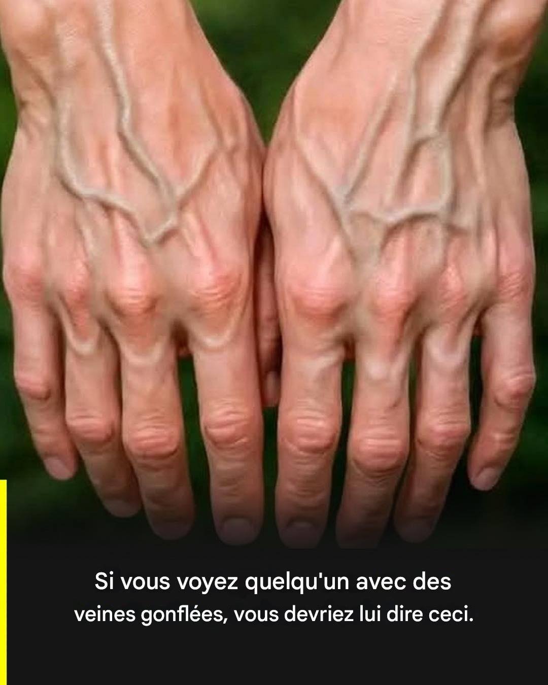 607392562 845526068111621 8342083009947498811 n