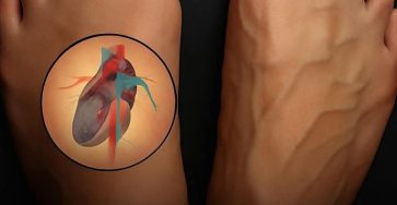 6323bdd5 99cc 46ea 9297 3b2407f3c64e