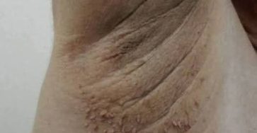 7d5a1c06 f153 45d9 b83f 4fbeef6dec25