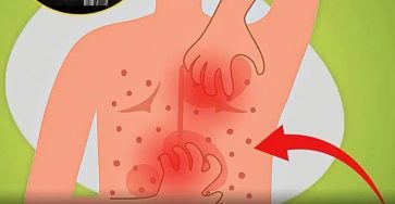 Aa8f217f 8845 4382 b7ce 71563eb5056c