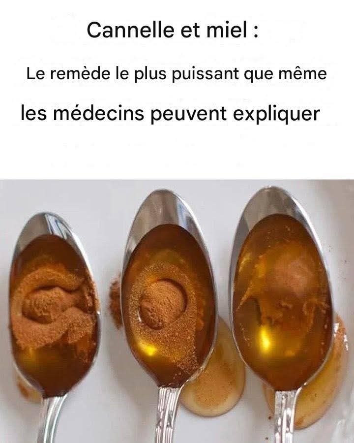 Ae299de0 1155 44c5 b388 138eff59d458