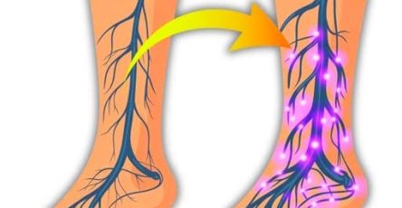 Boissons neuropathie