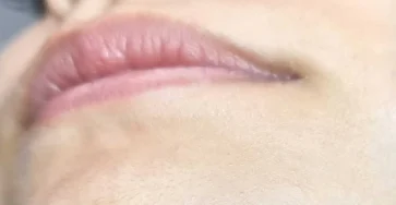 Si vous etes une femme avec des poils au menton soyez attentive voici ce que cela signifie.jpg